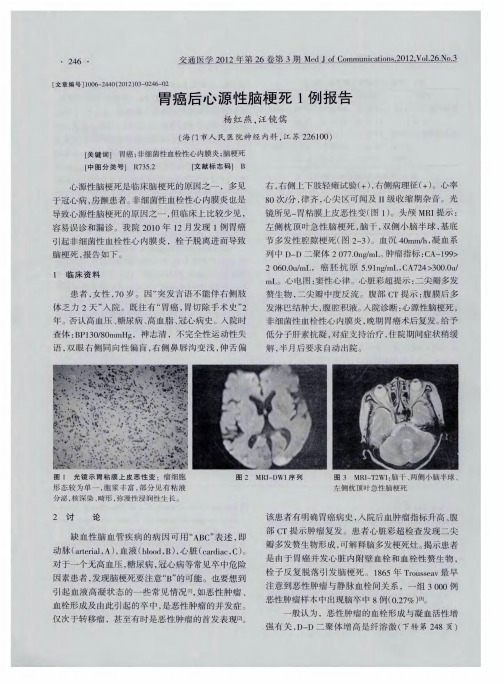 胃癌后心源性脑梗死1例报告