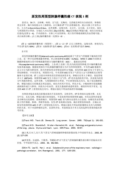 原发性周围型肺腺样囊性癌CT表现1例