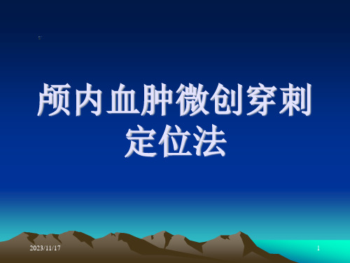 颅内血肿穿刺定位法