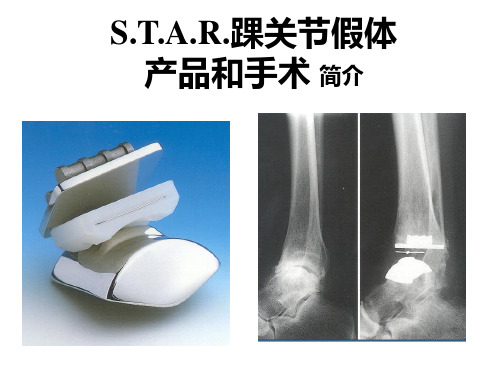 最新 踝关节置换手术步骤