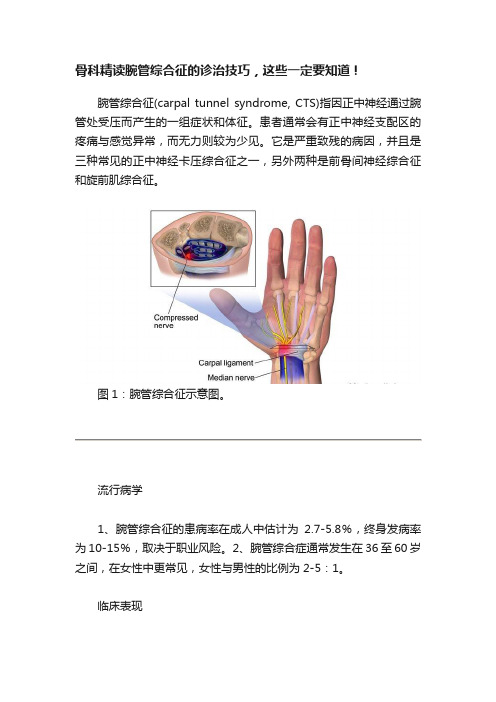 骨科精读腕管综合征的诊治技巧，这些一定要知道！