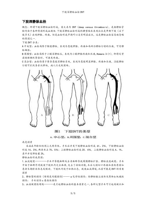 下肢深静脉血栓DVT