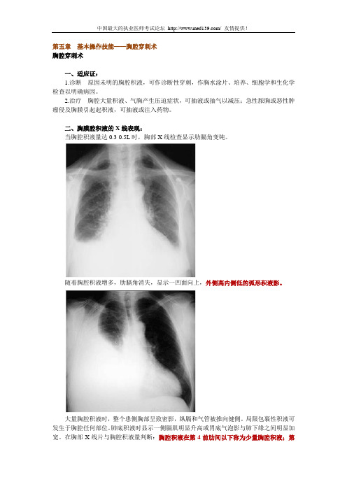 执业医师操作技能——胸腔穿刺术