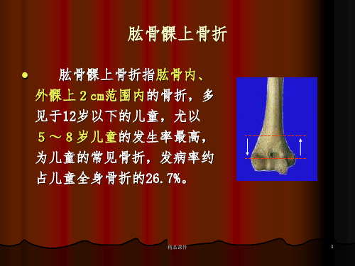 肱骨髁上骨折47315ppt课件