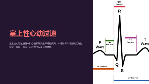 《室上性心动过速》课件