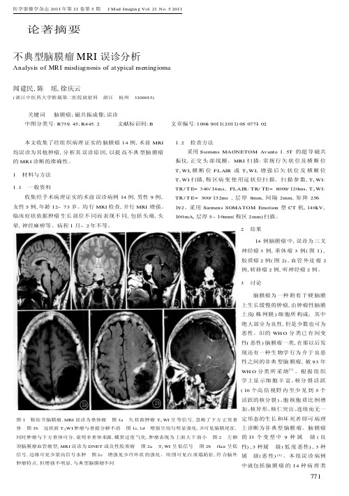 不典型脑膜瘤MRI误诊分析