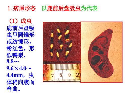 前后盘吸虫病PPT课件