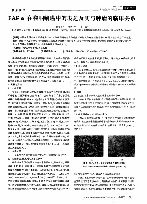 FAPα在喉咽鳞癌中的表达及其与肿瘤的临床关系