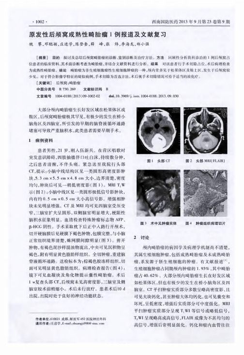 原发性后颅窝成熟性畸胎瘤1例报道及文献复习