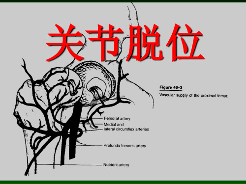 关节脱位