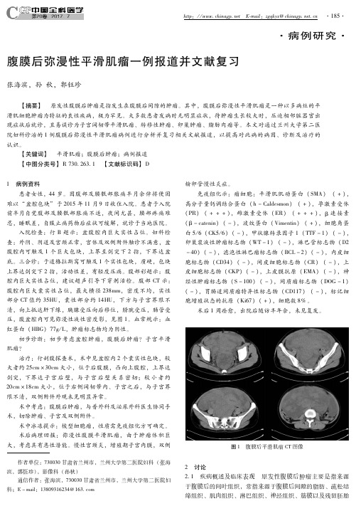 腹膜后弥漫性平滑肌瘤一例报道并文献复习