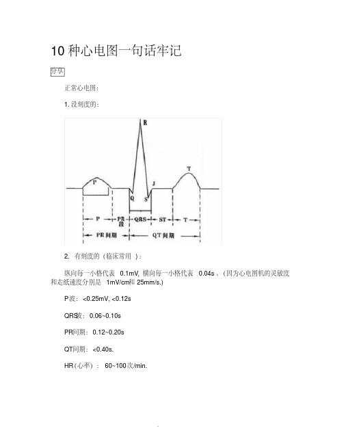 心电图口诀