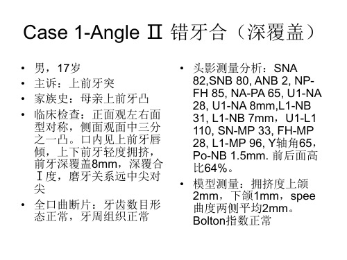 口腔正畸案例分析