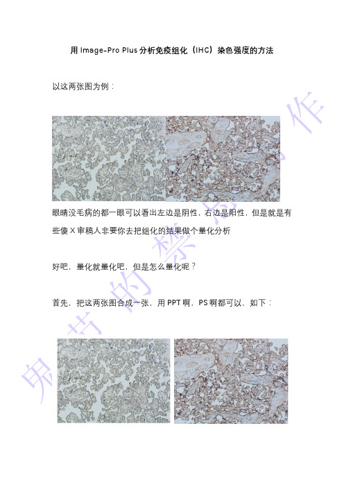 用Image-Pro Plus分析免疫组化(IHC)染色强度的方法