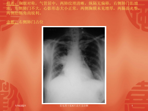 常见四十张X片读片及诊断培训课件