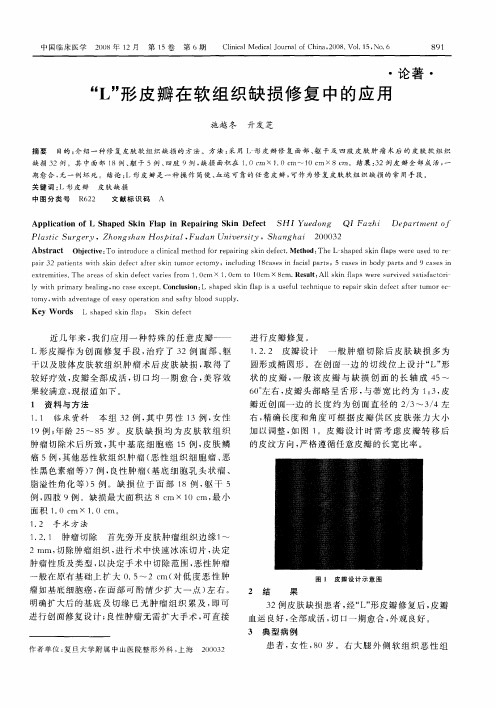 “L”形皮瓣在软组织缺损修复中的应用