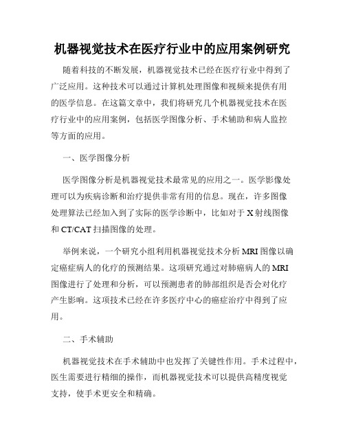 机器视觉技术在医疗行业中的应用案例研究