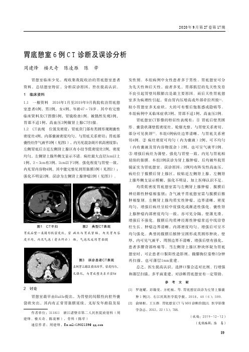 胃底憩室6例CT诊断及误诊分析