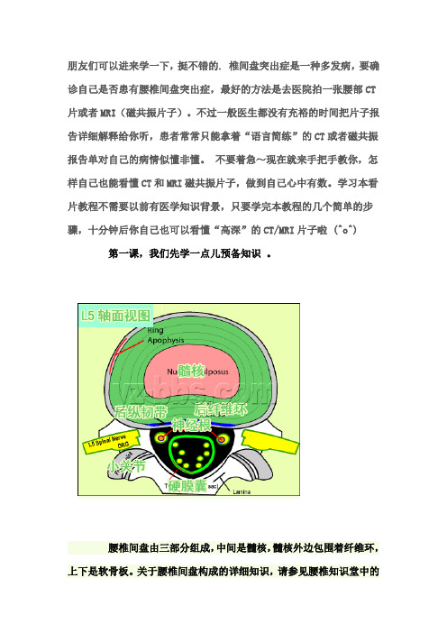 学会看腰椎间盘突出CT和MRI磁共振片子