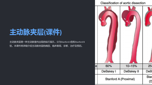 主动脉夹层(课件)