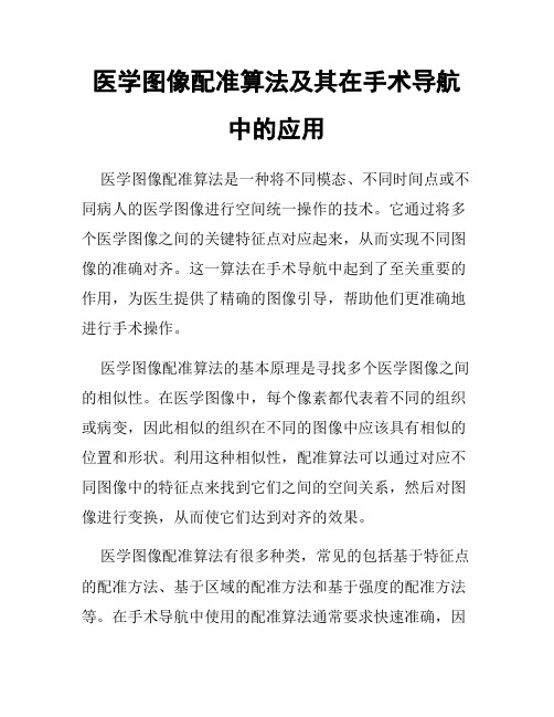 医学图像配准算法及其在手术导航中的应用