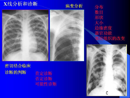 学习胸部x线片PPT课件