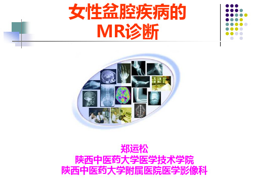 磁共振诊断学MRI课件 女性盆腔疾病MR表现