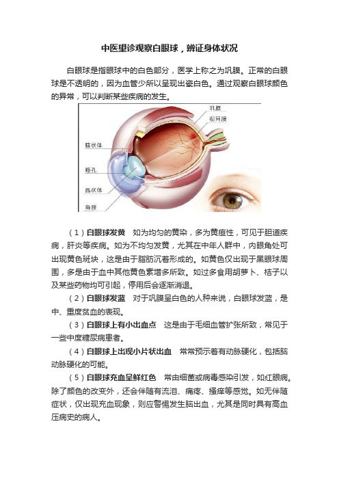 中医望诊观察白眼球，辨证身体状况