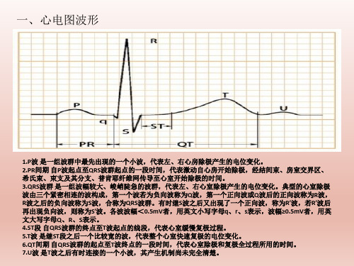 心电图基础知识讲解