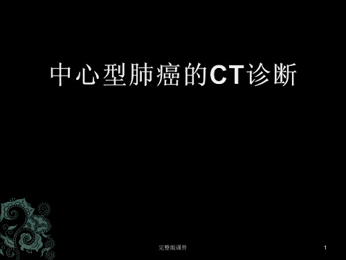 中心型肺癌的CT诊断(全面)ppt课件