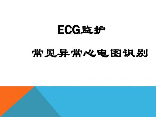 ECG监护及常见异常心电图的识别.pptx