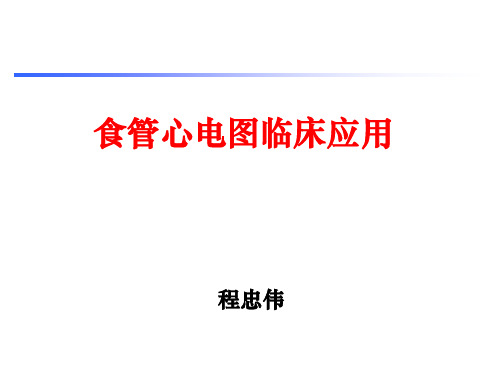 食管心电图的介绍及临床应用