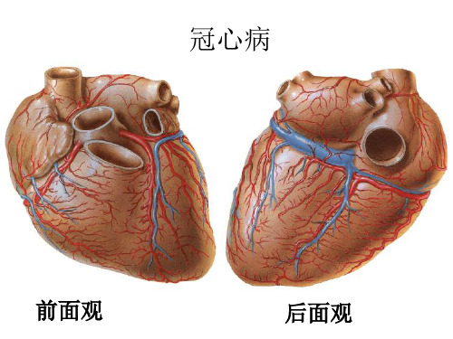 冠心病的影像学检查