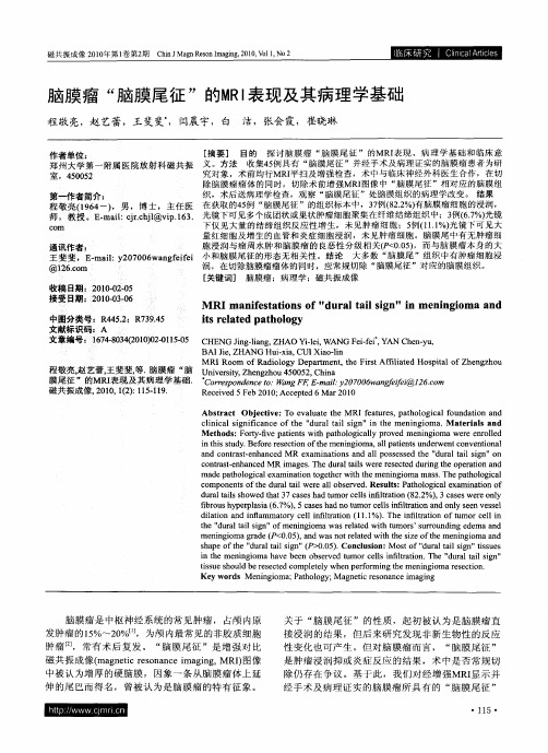 脑膜瘤“脑膜尾征”的MRI表现及其病理学基础