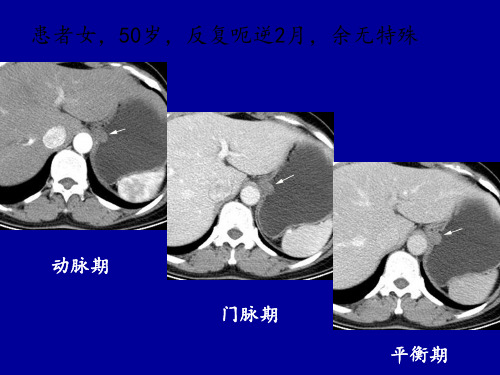 医学影像病例讨论课件