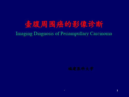 壶腹周围癌的影像诊断最新