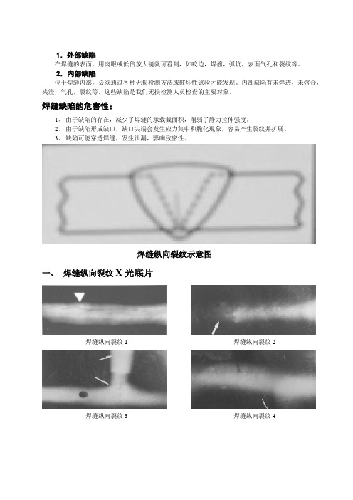 射线检测-焊缝缺陷图谱