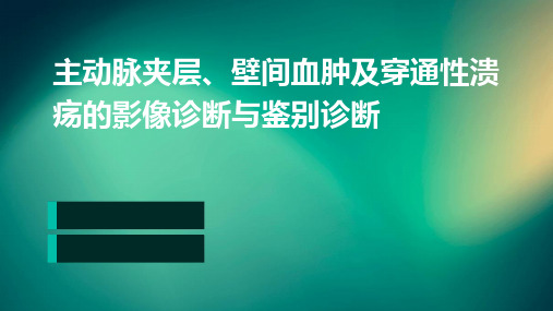 主动脉夹层、壁间血肿及穿通性溃疡的影像诊断与鉴别诊断