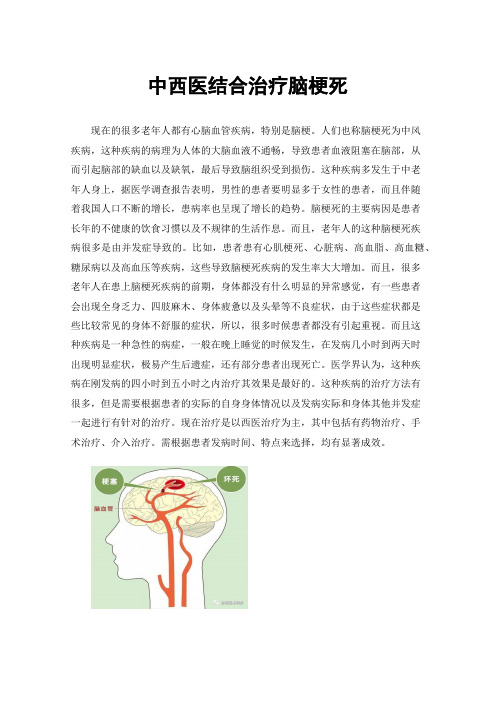 中西医结合治疗脑梗死