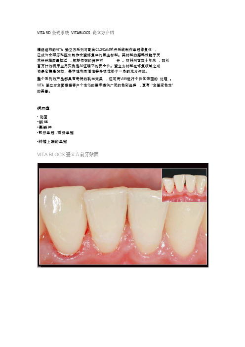 VITA 3D全瓷系统 VITABLOCS 瓷立方介绍