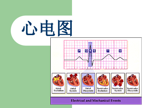 心电图ECG