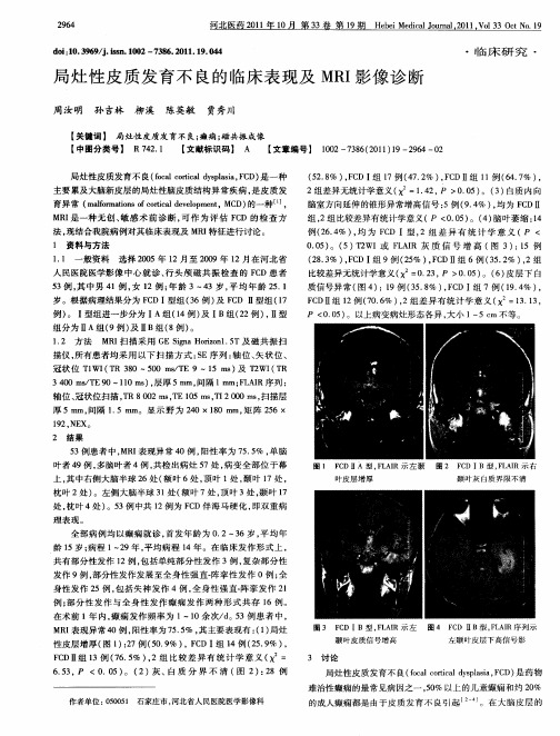 局灶性皮质发育不良的临床表现及MRI影像诊断