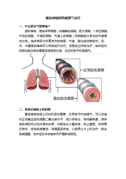 重症哮喘的机械通气治疗