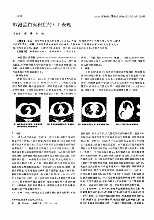 肺泡蛋白沉积症的CT表现