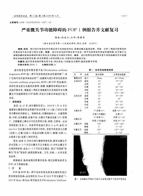 严重髋关节功能障碍的FOP1例报告并文献复习