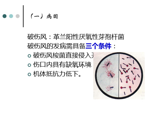 1113破伤风共37页文档