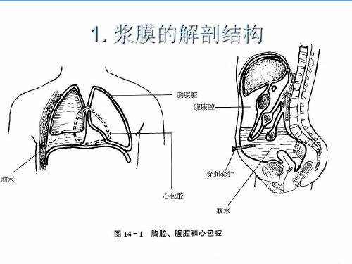 浆膜腔积液细胞病理学诊断(1)