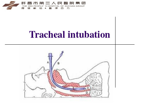 气管插管英文版