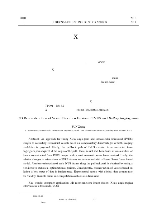 应用血管内超声与X射线造影图像融合的血管三维重建