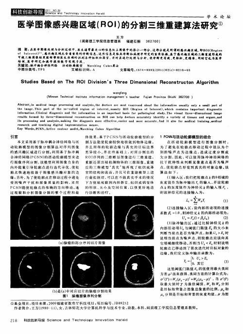 医学图像感兴趣区域(ROI)的分割三维重建算法研究